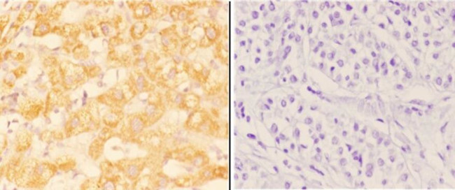 ABHD13 Antibody in Immunohistochemistry (Paraffin) (IHC (P))