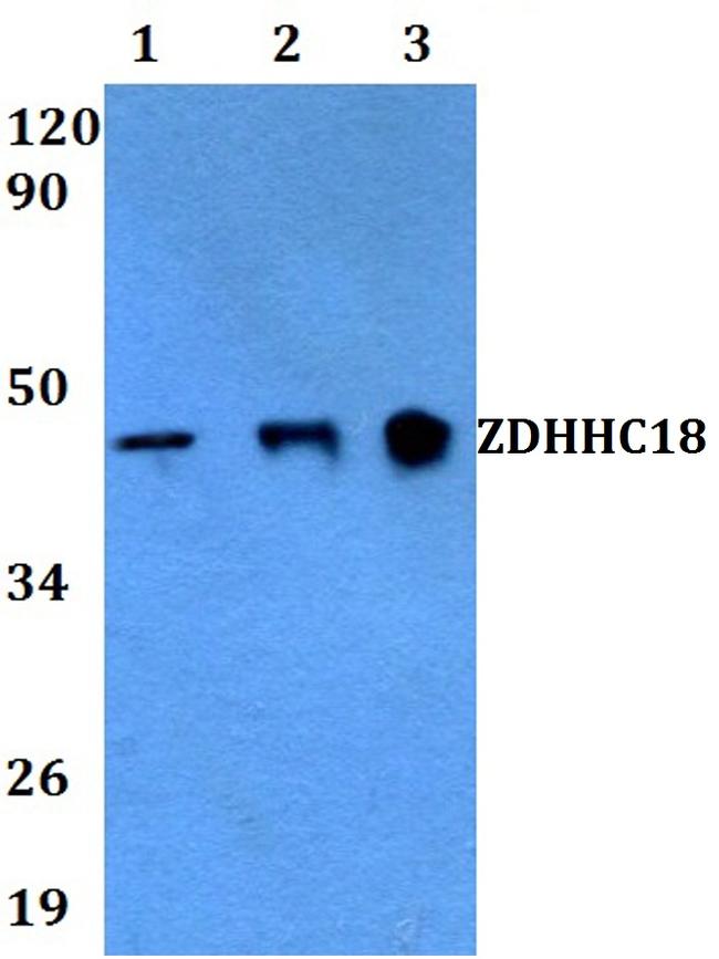 ZDHHC18 Antibody in Western Blot (WB)