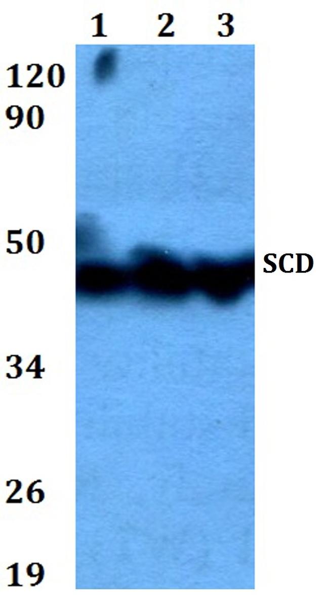 SCD Antibody in Western Blot (WB)