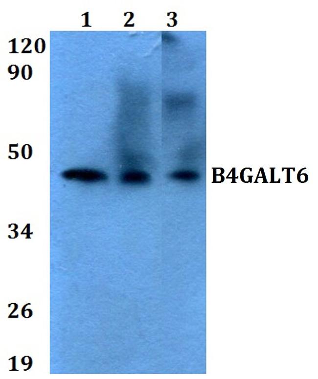 B4GALT6 Antibody in Western Blot (WB)