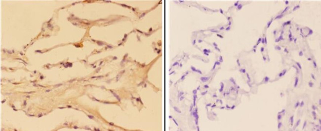 ABHD3 Antibody in Immunohistochemistry (Paraffin) (IHC (P))