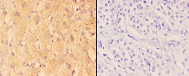 ABHD3 Antibody in Immunohistochemistry (Paraffin) (IHC (P))