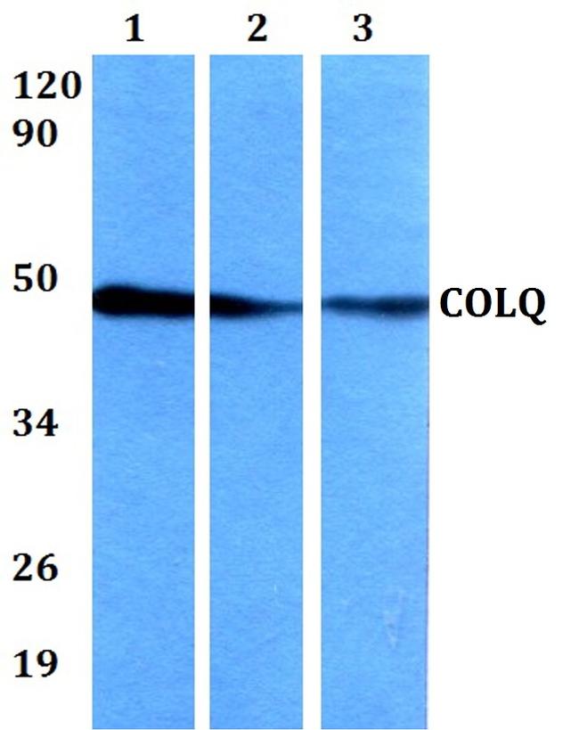 COLQ Antibody in Western Blot (WB)