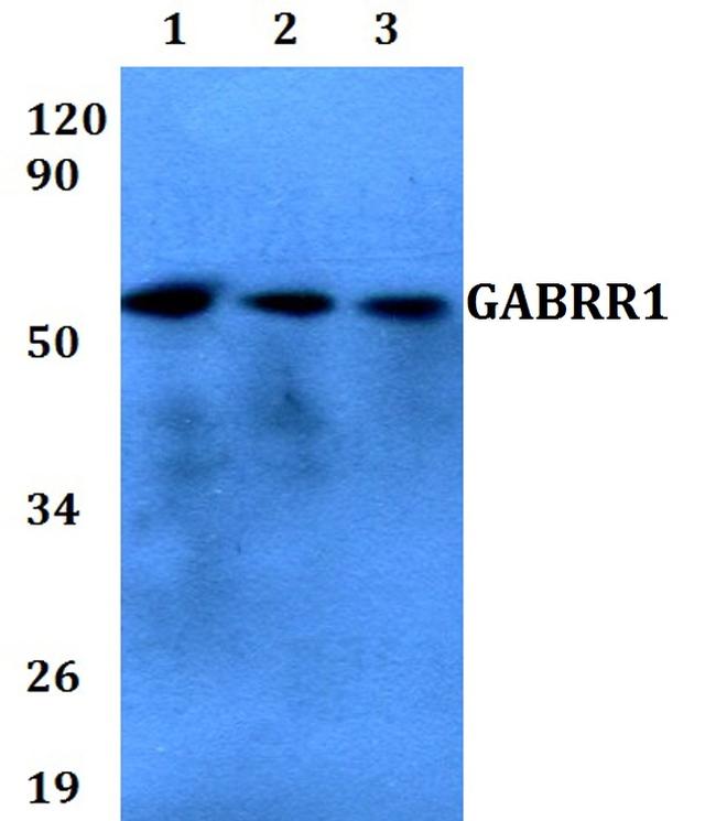 GABRR1 Antibody in Western Blot (WB)