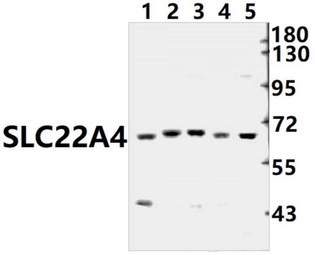 SLC22A4 Antibody in Western Blot (WB)