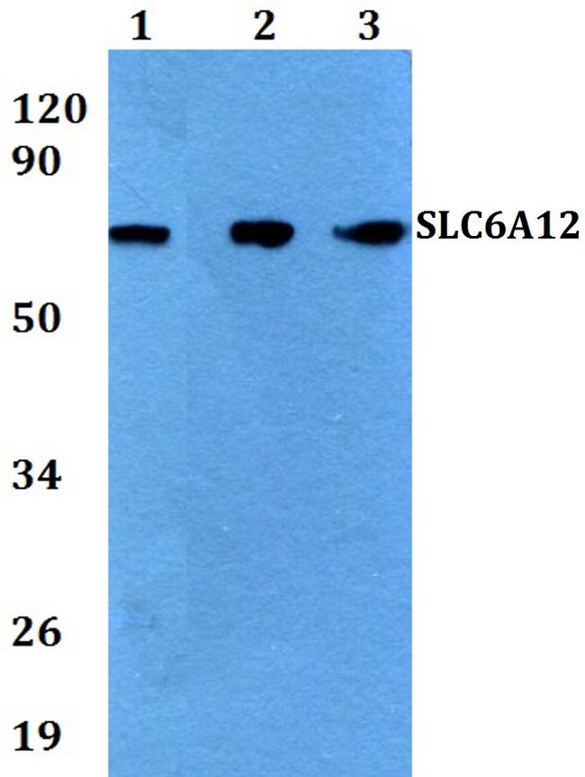 SLC6A12 Antibody in Western Blot (WB)