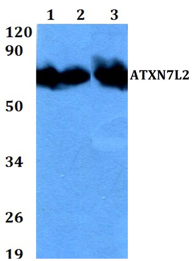 ATXN7L2 Antibody in Western Blot (WB)