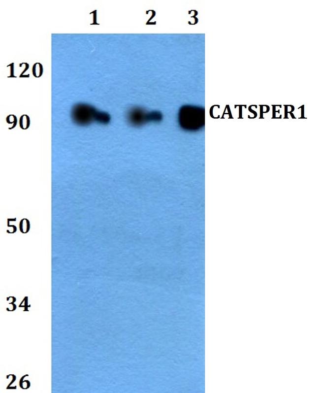 CATSPER1 Antibody in Western Blot (WB)