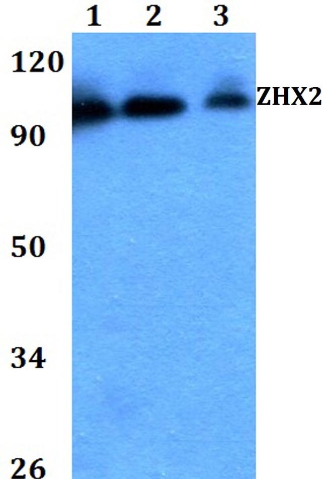 ZHX2 Antibody in Western Blot (WB)