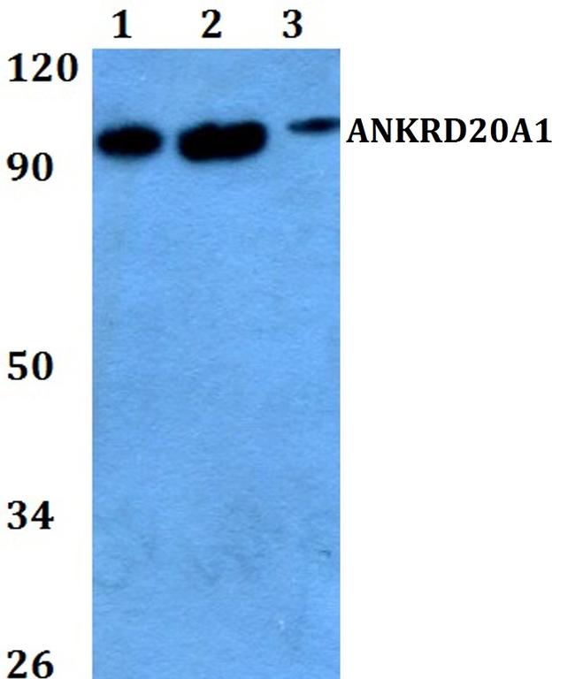 A20A1 Antibody in Western Blot (WB)