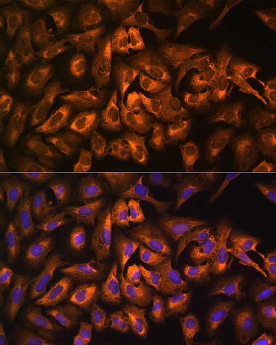 EEF1A1 Antibody in Immunocytochemistry (ICC/IF)