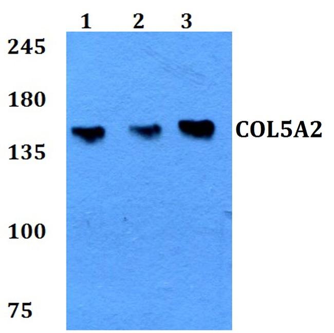 COL5A2 Antibody in Western Blot (WB)