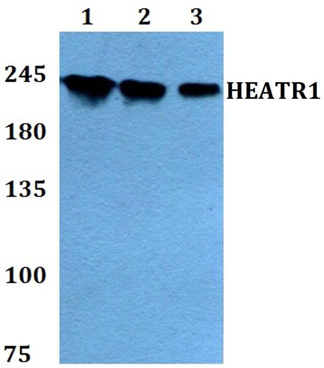 HEATR1 Antibody in Western Blot (WB)