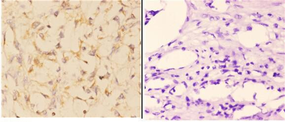 ABCA4 Antibody in Immunohistochemistry (Paraffin) (IHC (P))