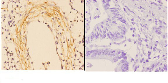 ABCA4 Antibody in Immunohistochemistry (Paraffin) (IHC (P))