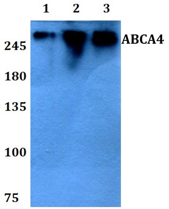 ABCA4 Antibody in Western Blot (WB)