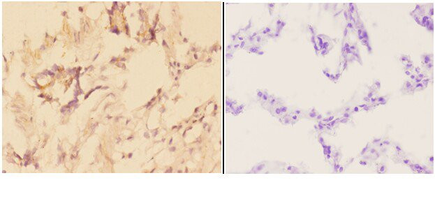 ADAMTS10 Antibody in Immunohistochemistry (Paraffin) (IHC (P))