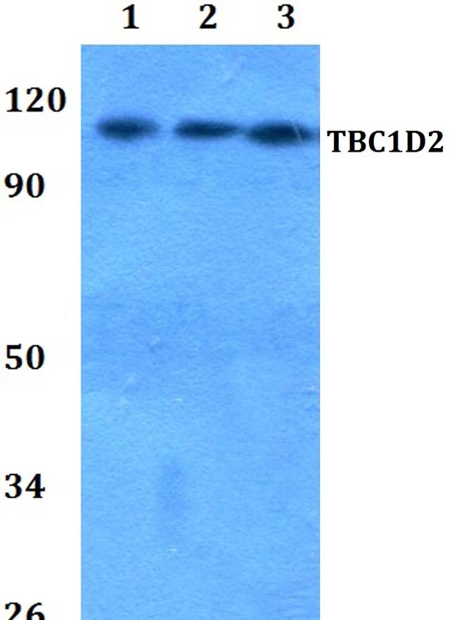 TBC1D2 Antibody in Western Blot (WB)