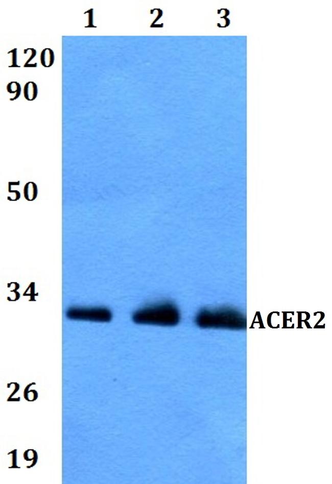 ACER2 Antibody in Western Blot (WB)