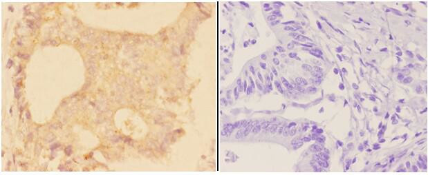 ADAM28 Antibody in Immunohistochemistry (Paraffin) (IHC (P))