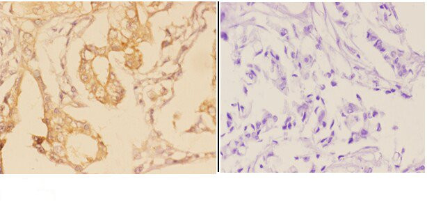 ADAM28 Antibody in Immunohistochemistry (Paraffin) (IHC (P))