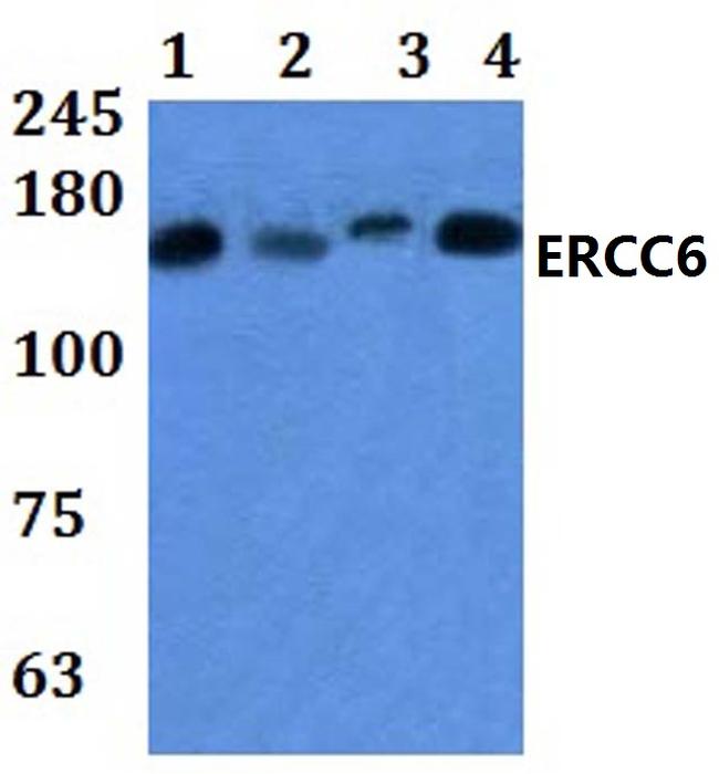 CSB Antibody in Western Blot (WB)