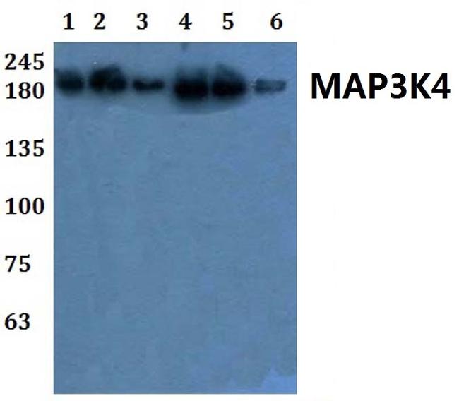 MEKK4 Antibody in Western Blot (WB)