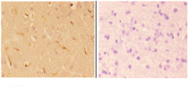 ABHD4 Antibody in Immunohistochemistry (Paraffin) (IHC (P))