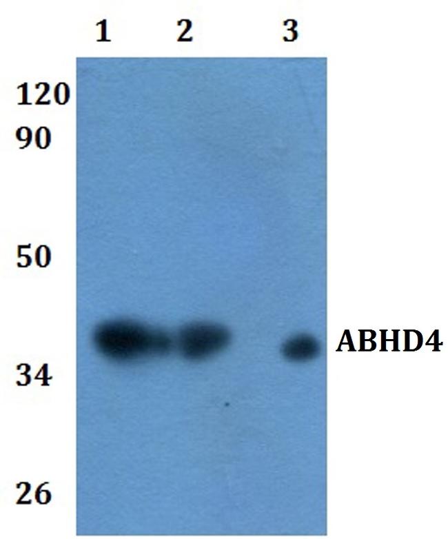 ABHD4 Antibody in Western Blot (WB)