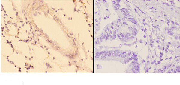 ACOT9 Antibody in Immunohistochemistry (Paraffin) (IHC (P))