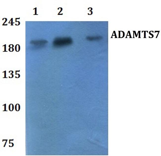 ADAMTS7 Antibody in Western Blot (WB)