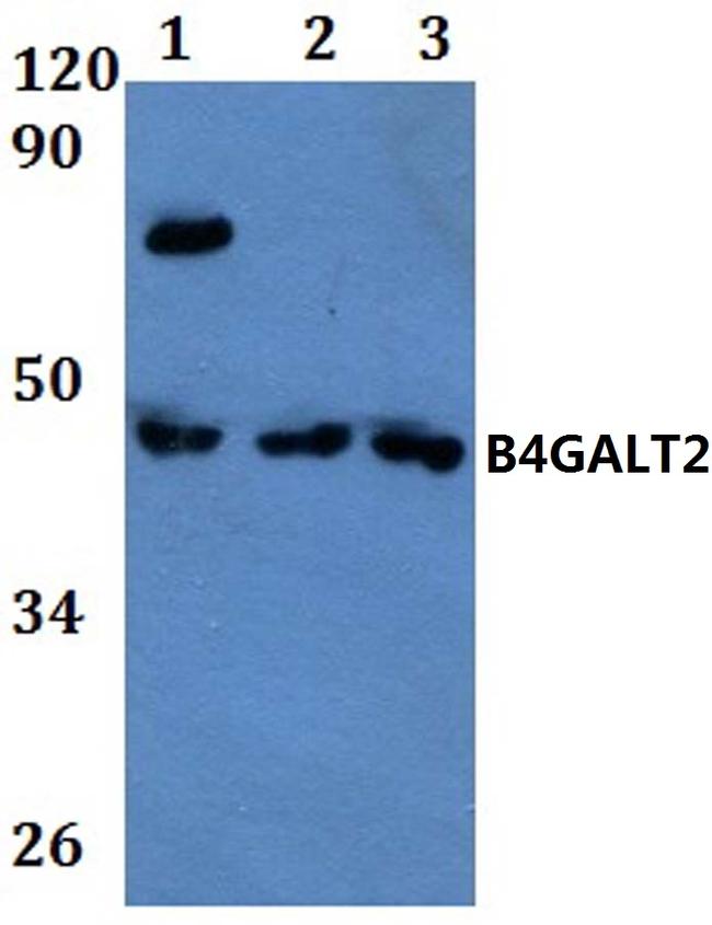 B4GALT2 Antibody in Western Blot (WB)