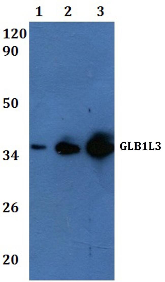 GLB1L3 Antibody in Western Blot (WB)