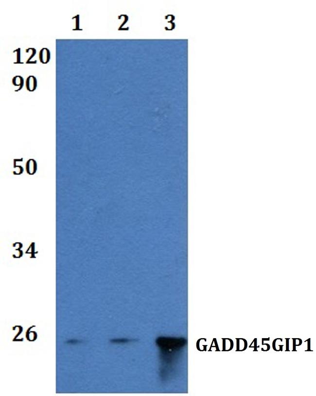 GADD45GIP1 Antibody in Western Blot (WB)