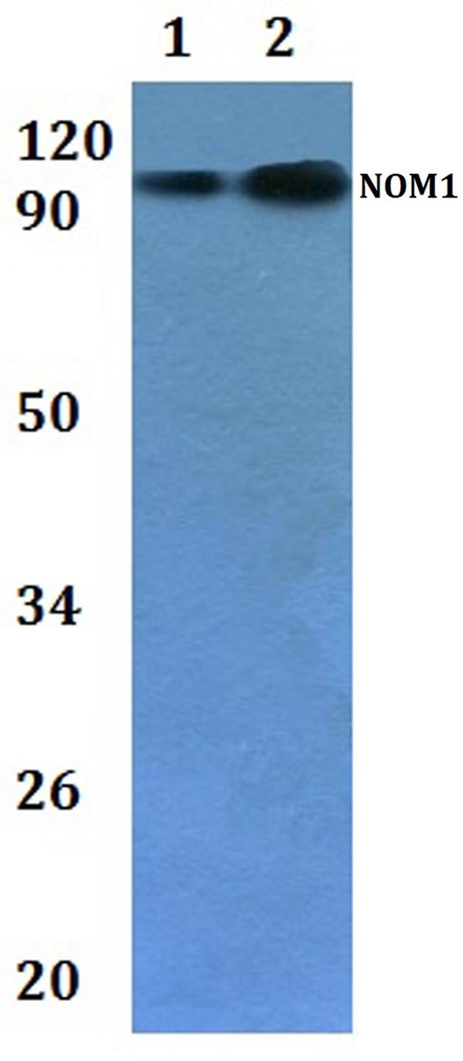 NOM1 Antibody in Western Blot (WB)