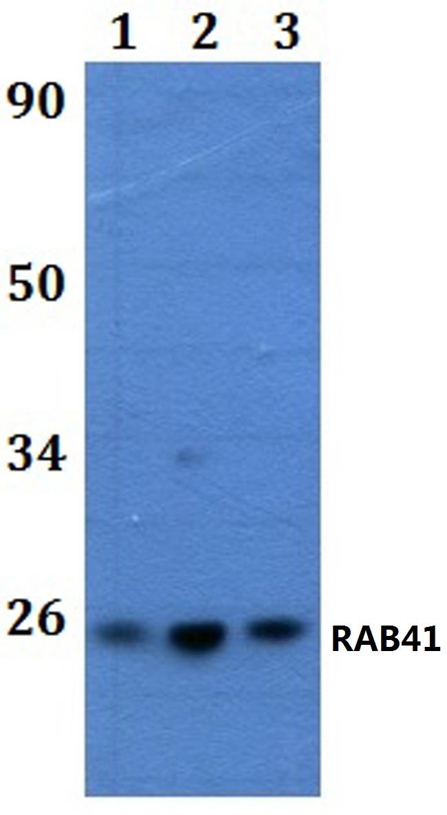 RAB41 Antibody in Western Blot (WB)