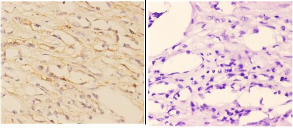 ABCA7 Antibody in Immunohistochemistry (Paraffin) (IHC (P))