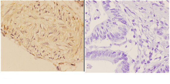 ABCA7 Antibody in Immunohistochemistry (Paraffin) (IHC (P))