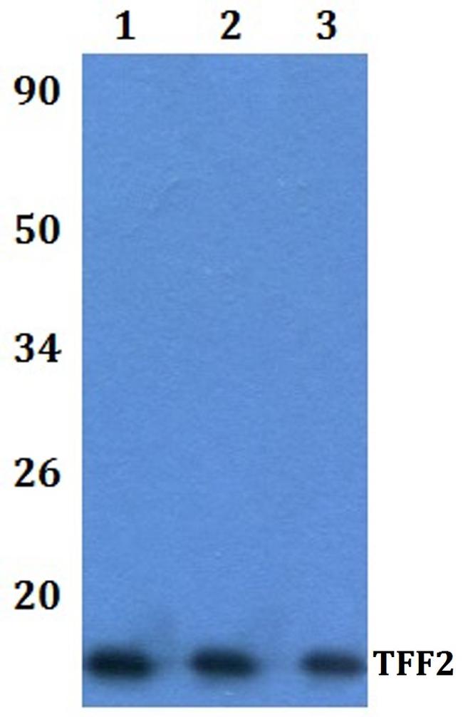 TFF2 Antibody in Western Blot (WB)