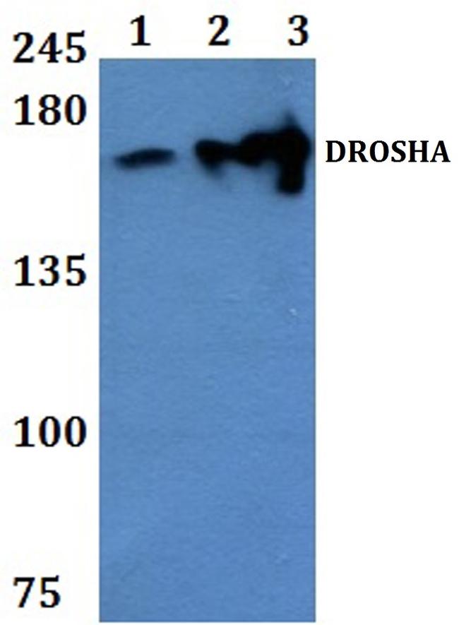 Drosha Antibody in Western Blot (WB)