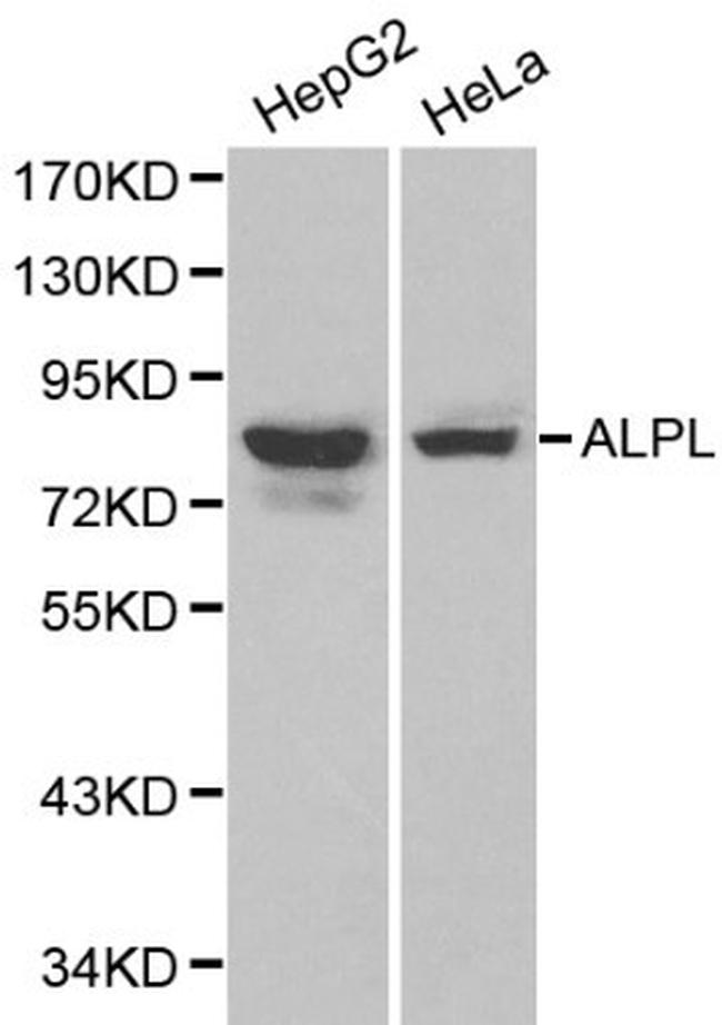 ALPL Antibody in Western Blot (WB)