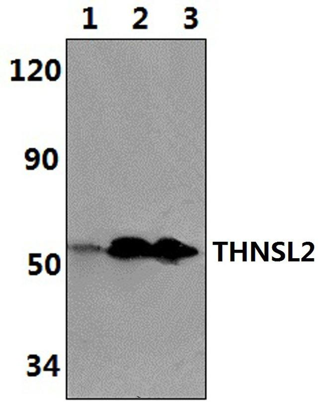 THNSL2 Antibody in Western Blot (WB)