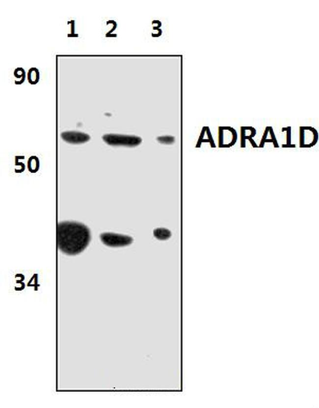 alpha-1d Adrenoceptor Antibody in Western Blot (WB)