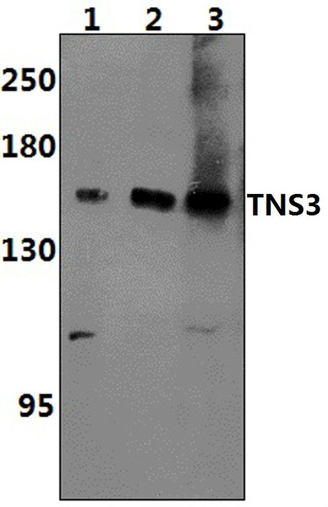 Tensin 3 Antibody in Western Blot (WB)