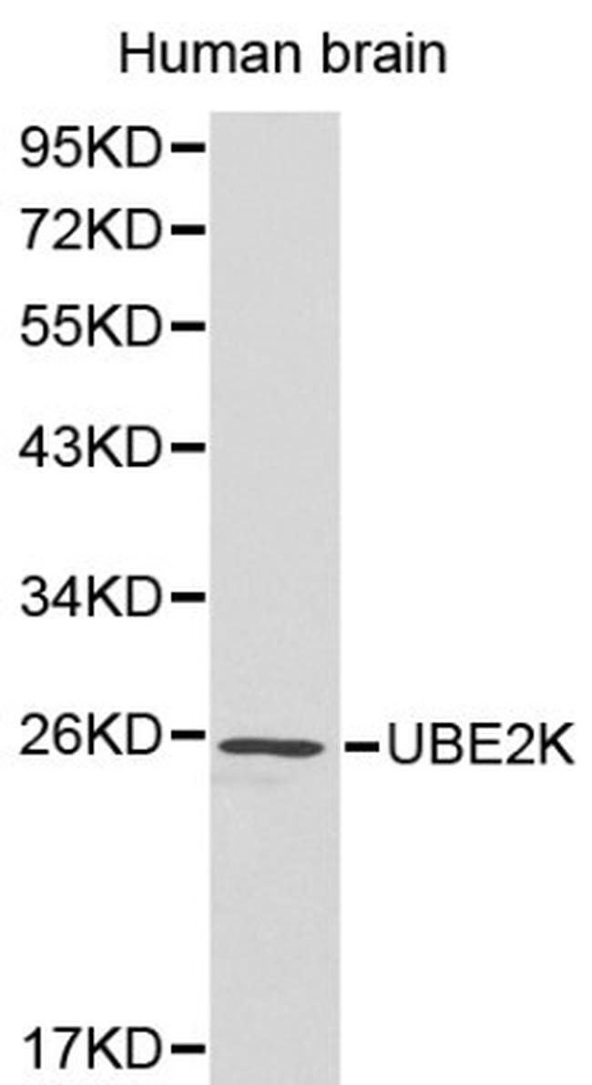 HIP2 Antibody in Western Blot (WB)
