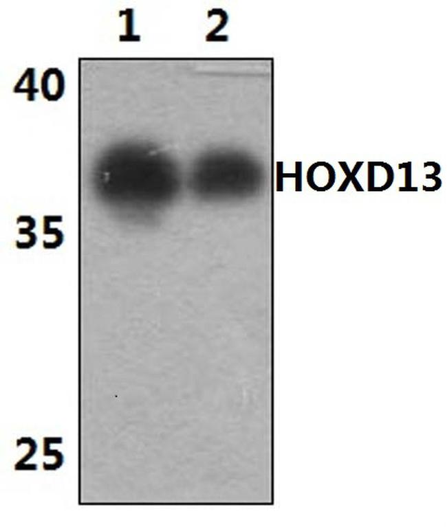 HOXD13 Antibody in Western Blot (WB)