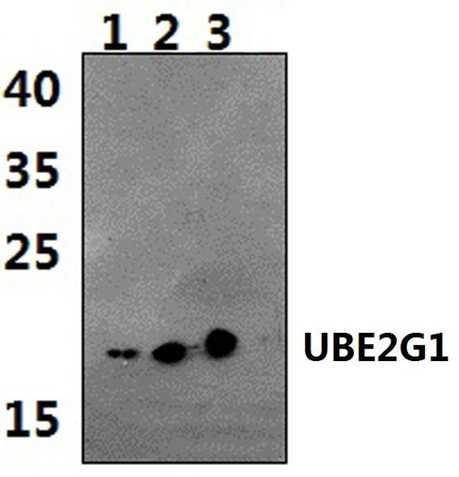 UBE2G1 Antibody in Western Blot (WB)