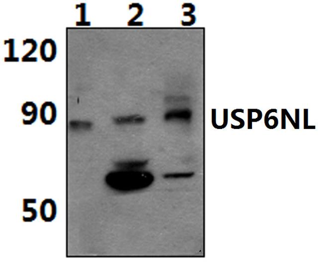 USP6NL Antibody in Western Blot (WB)