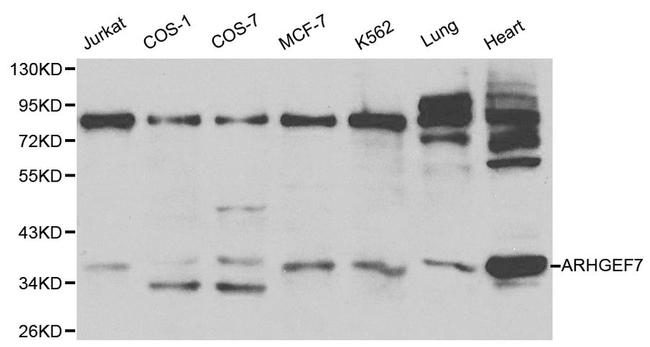 ARHGEF7 Antibody in Western Blot (WB)