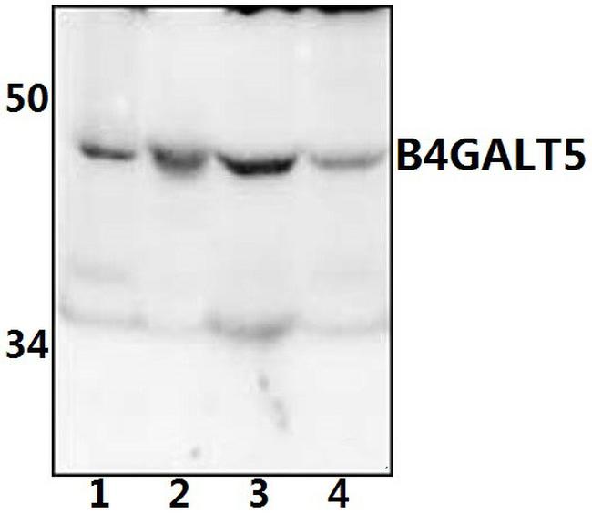 B4GALT5 Antibody in Western Blot (WB)